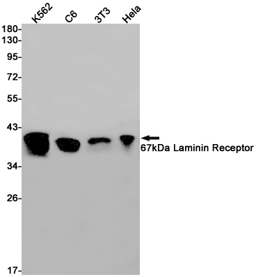 67kDa Laminin Receptor Rabbit mAb ABZ2811