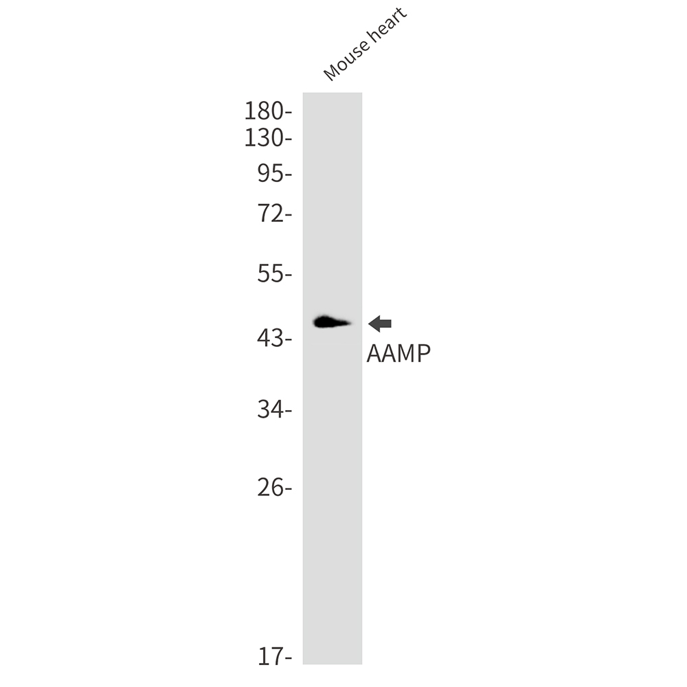 AAMP Rabbit mAb ABZ2813