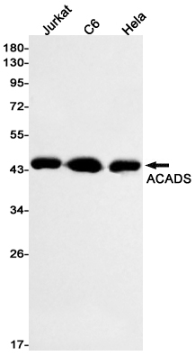 ACADS/SCAD Rabbit mAb ABZ2814