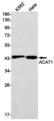 ACAT1 Rabbit mAb ABZ2815
