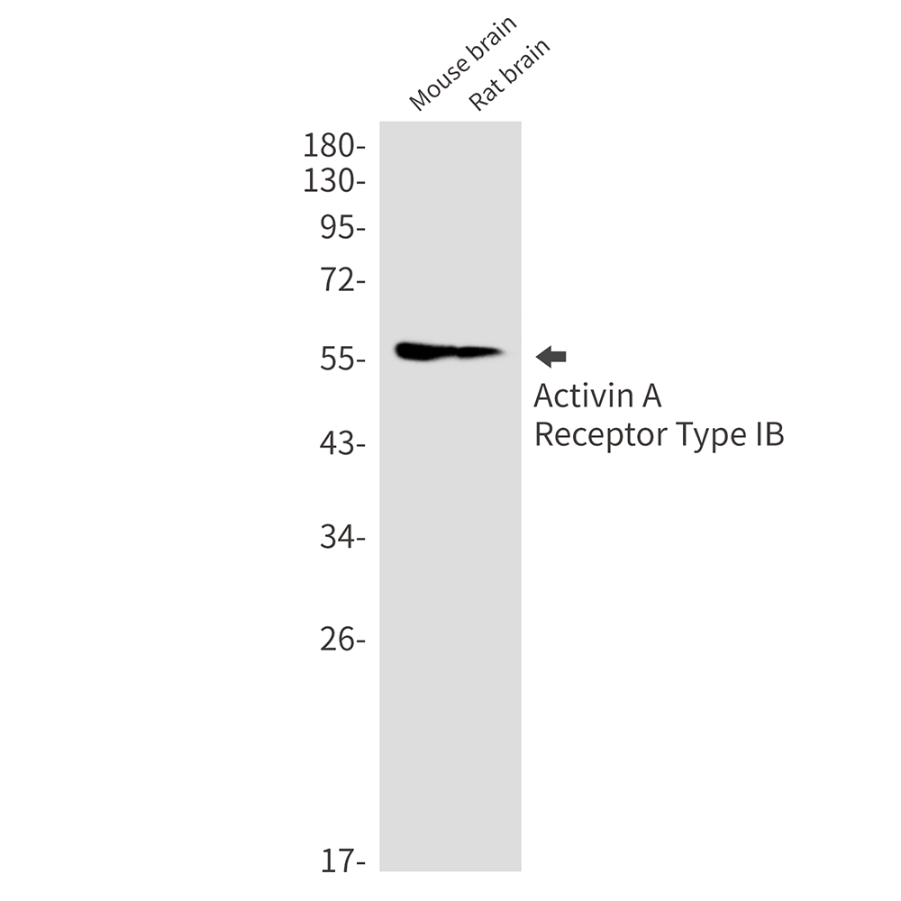 Activin A Receptor Type IB/ALK-4 Rabbit mAb ABZ2817