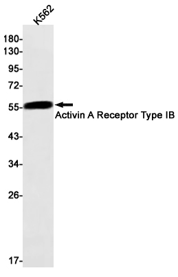 Activin A Receptor Type IB/ALK-4 Rabbit mAb ABZ2817