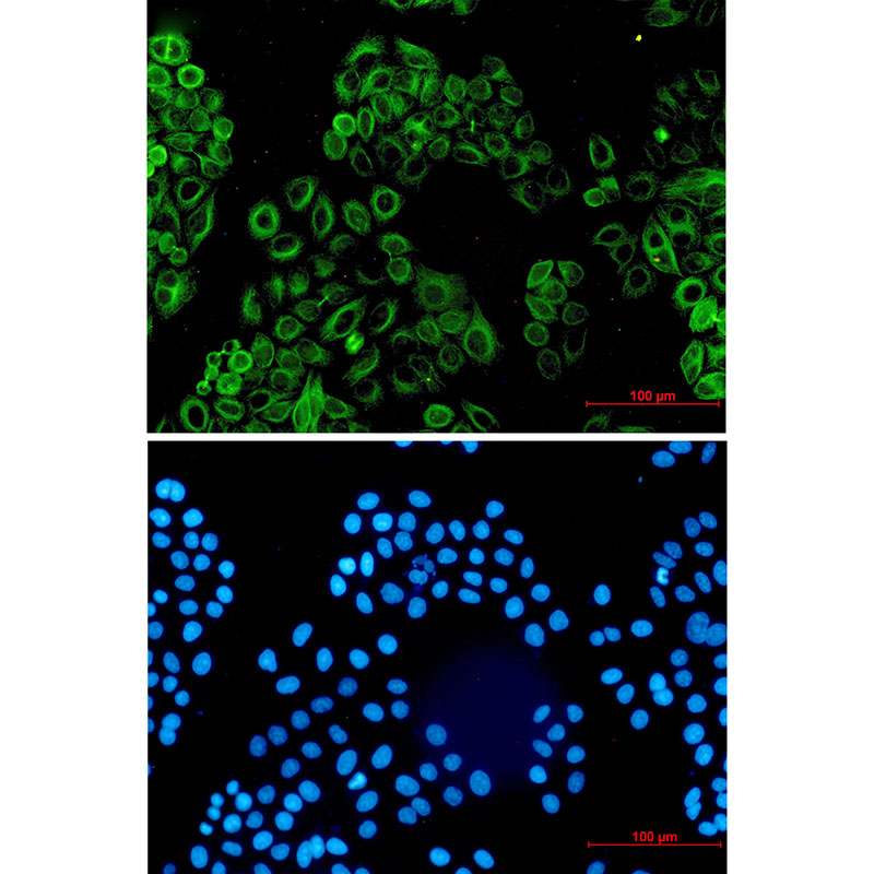 Activin A Receptor Type IB/ALK-4 Rabbit mAb ABZ2818