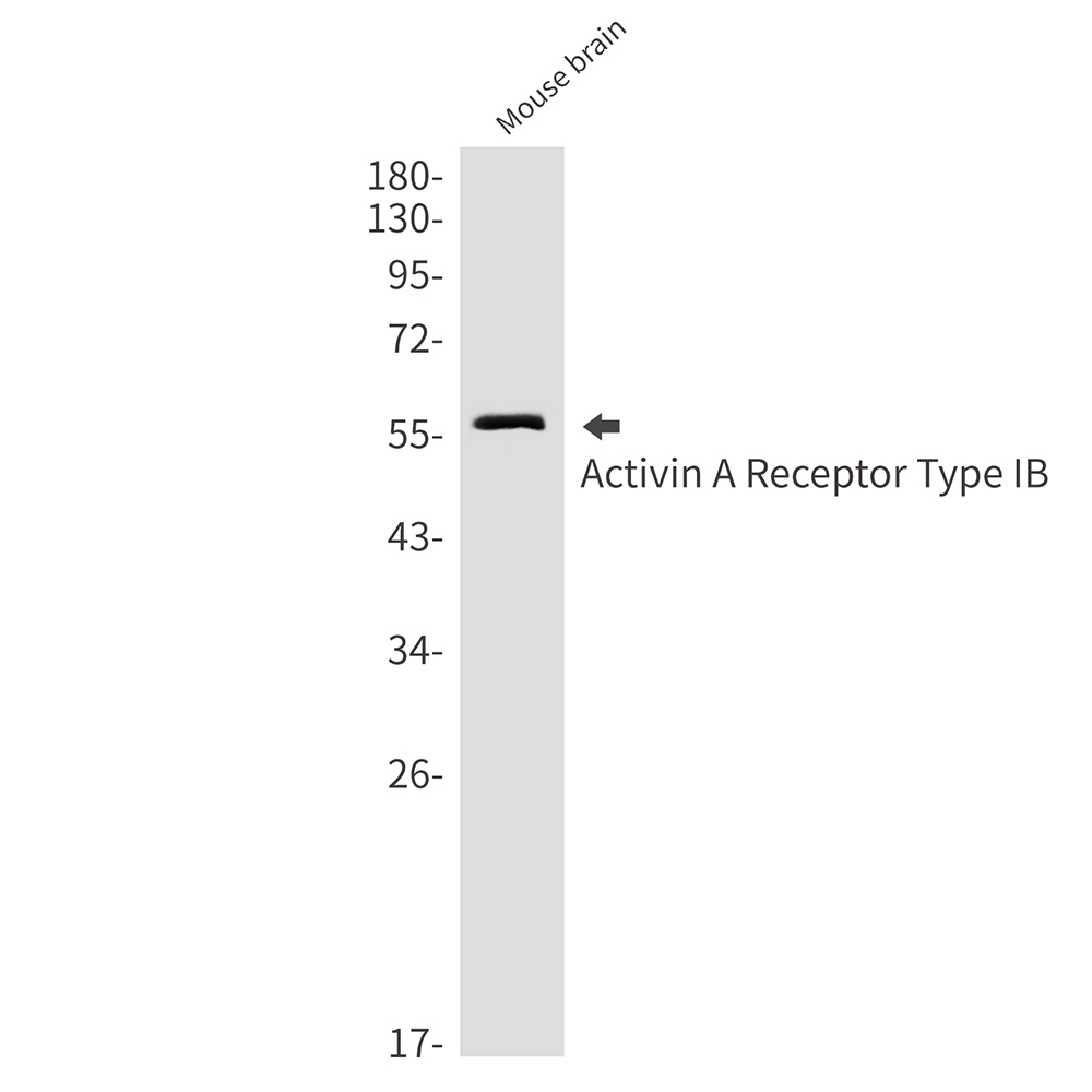 Activin A Receptor Type IB/ALK-4 Rabbit mAb ABZ2818