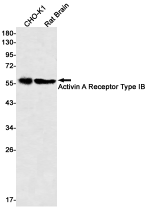 Activin A Receptor Type IB/ALK-4 Rabbit mAb ABZ2818