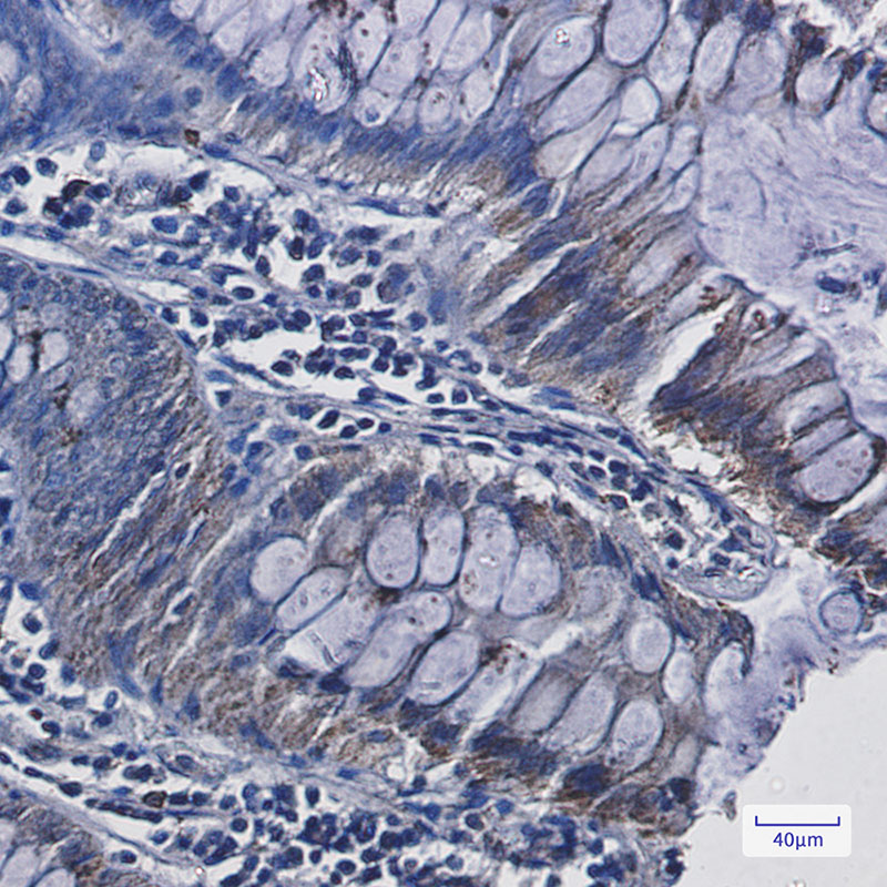 Adrenodoxin Rabbit mAb ABZ2820