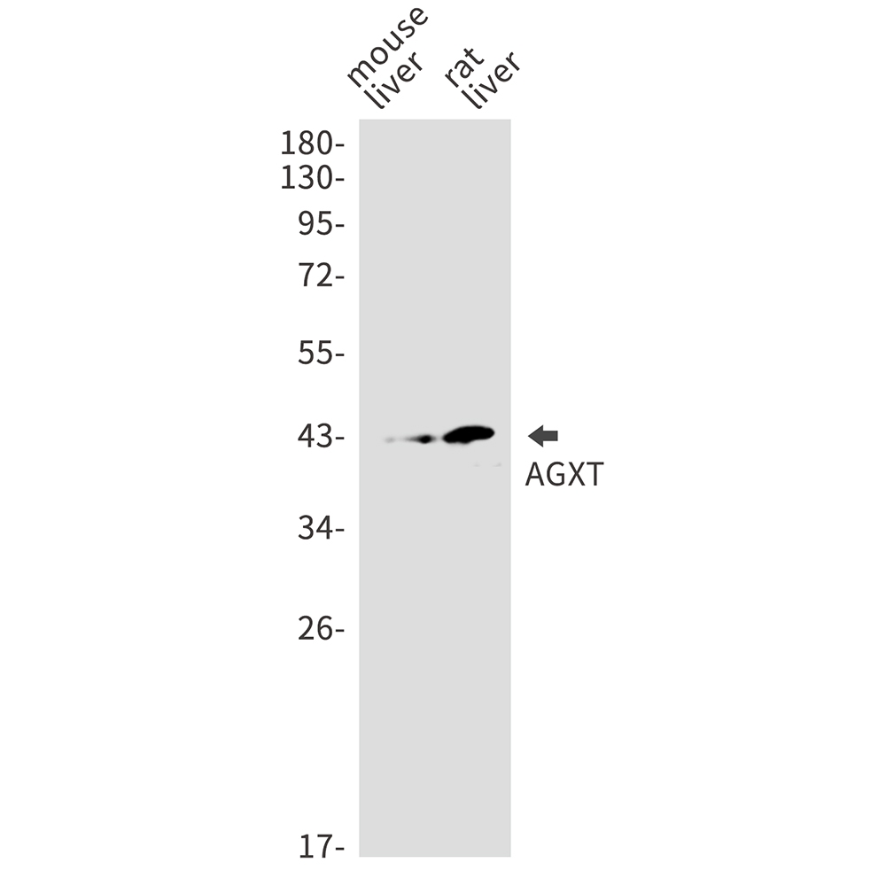 AGXT Rabbit mAb ABZ2822