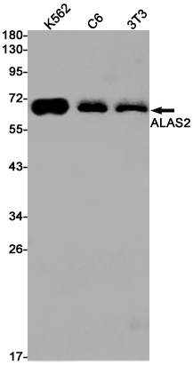 ALAS2/ASB Rabbit mAb ABZ2824