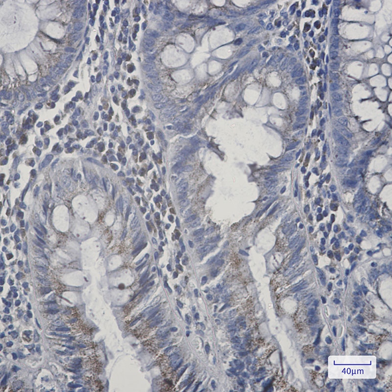 AGPS Rabbit mAb ABZ2825