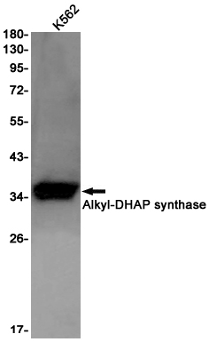 AGPS Rabbit mAb ABZ2825
