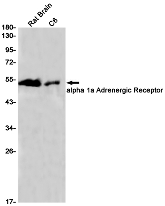 alpha 1a Adrenergic Receptor Rabbit mAb ABZ2826
