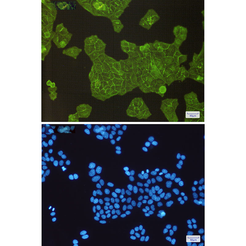 alpha Actinin 4 Rabbit mAb ABZ2827
