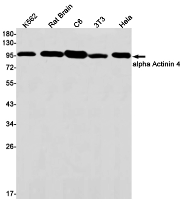 alpha Actinin 4 Rabbit mAb ABZ2827