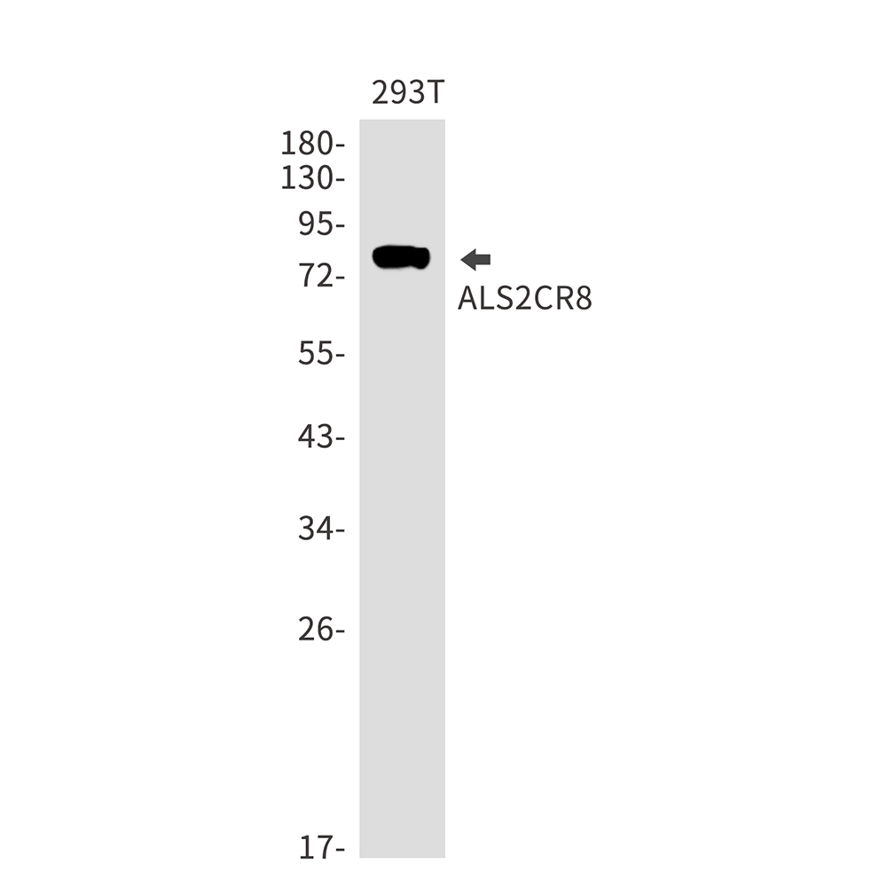 ALS2CR8 Rabbit mAb ABZ2829