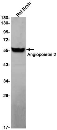 Angiopoietin 2/ANG2 Rabbit mAb ABZ2830