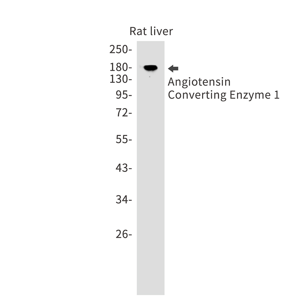 Angiotensin Converting Enzyme 1 Rabbit mAb ABZ2831