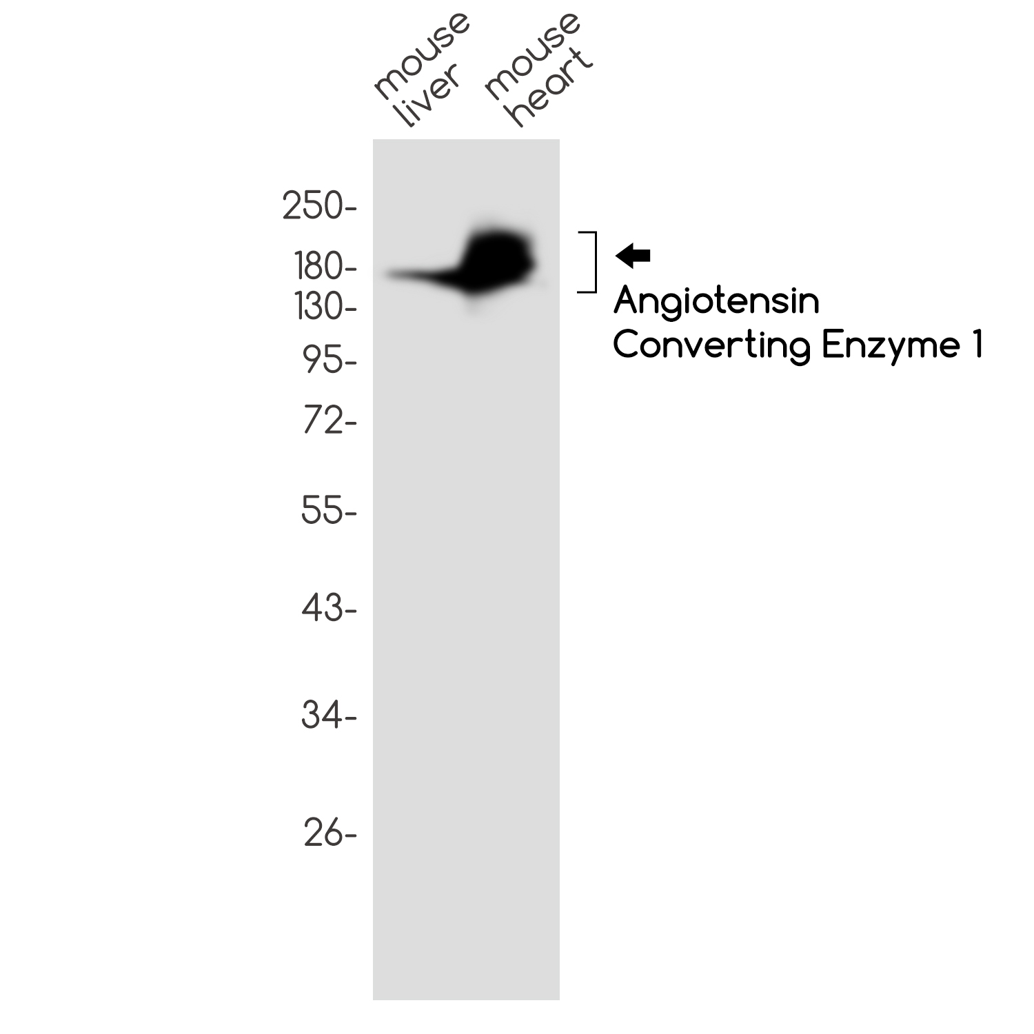 Angiotensin Converting Enzyme 1 Rabbit mAb ABZ2831