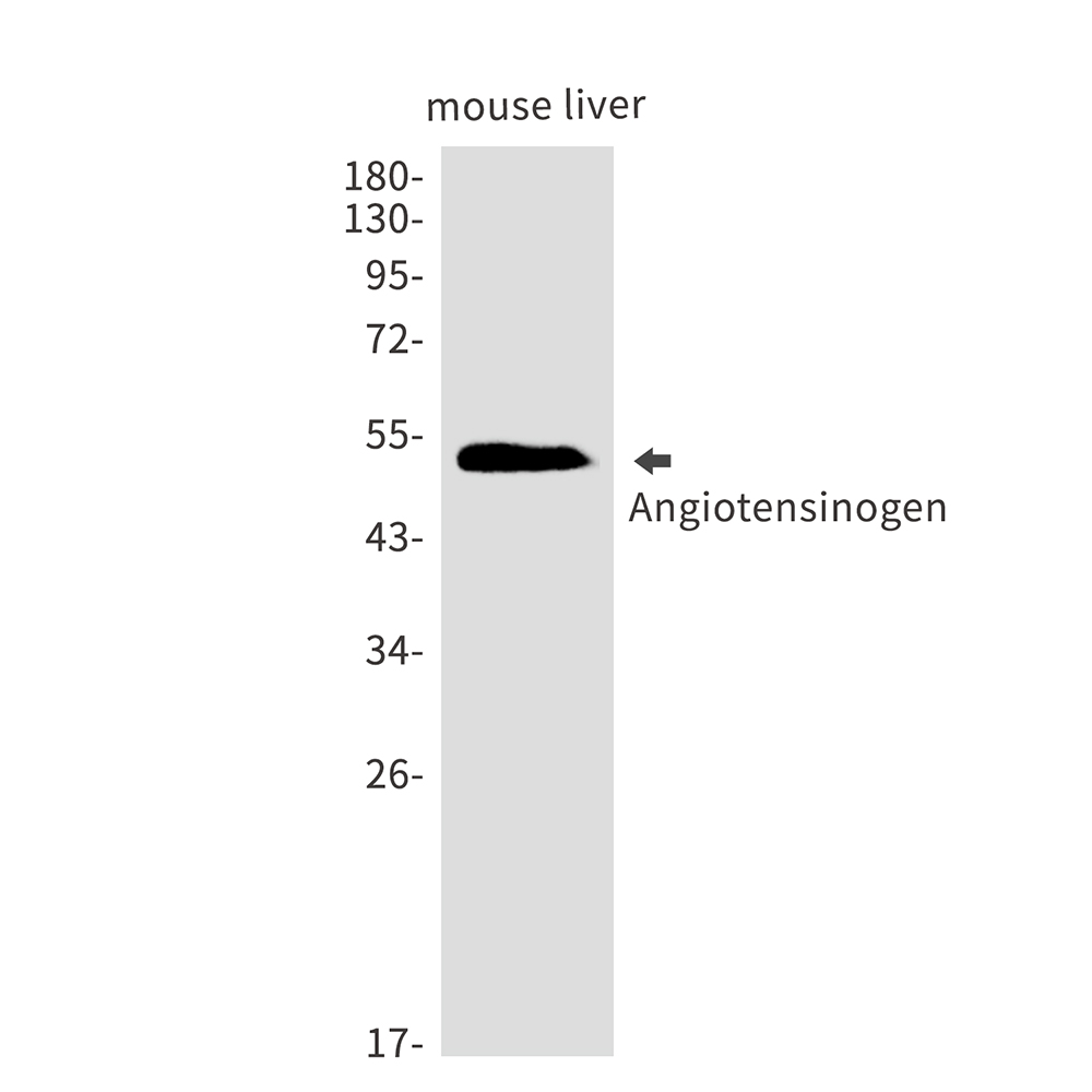 Angiotensinogen Rabbit mAb ABZ2832