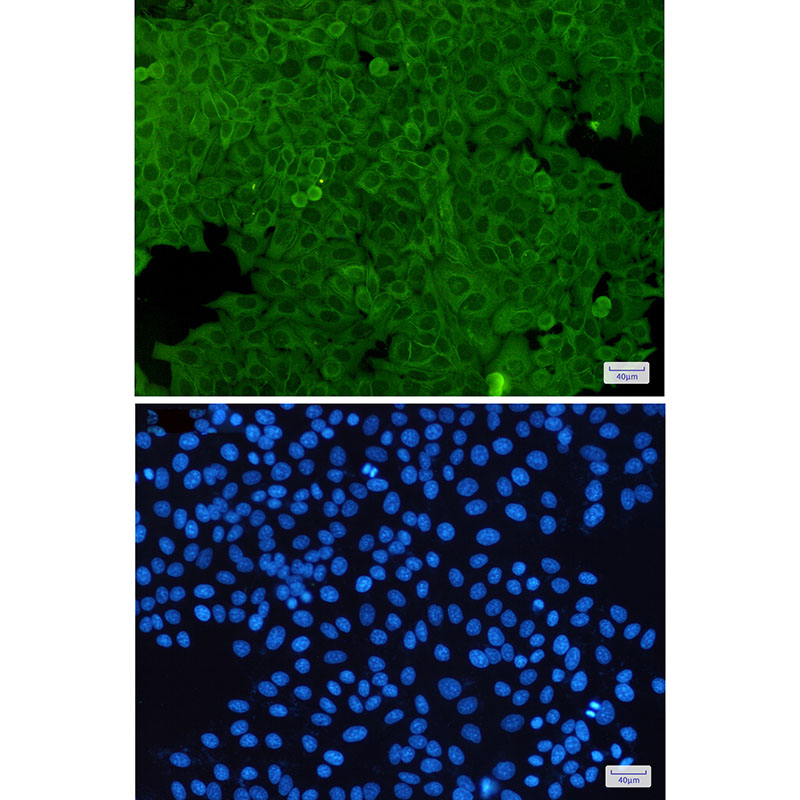 Annexin 2 Rabbit mAb ABZ2833