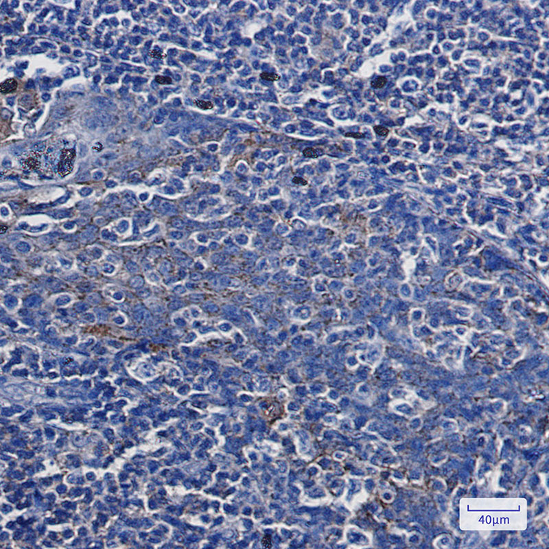 Annexin-7/ANXA7 Rabbit mAb ABZ2834