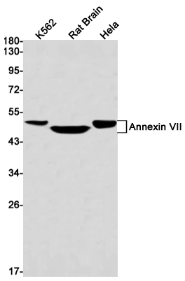 Annexin-7/ANXA7 Rabbit mAb ABZ2834