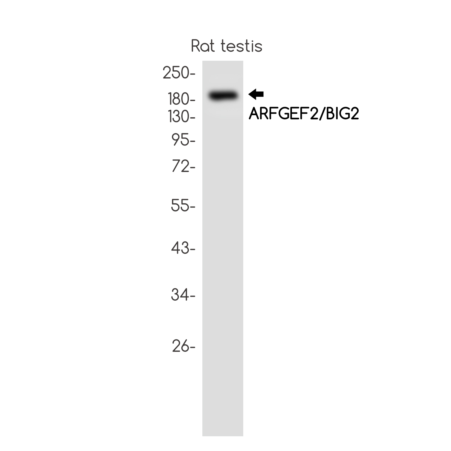 ARFGEF2 Rabbit mAb ABZ2837