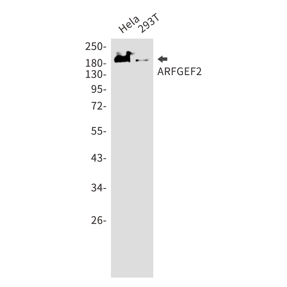 ARFGEF2 Rabbit mAb ABZ2837
