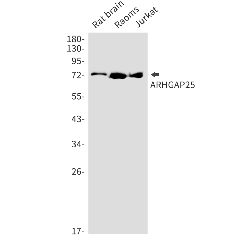 ARHGAP25 Rabbit mAb ABZ2838