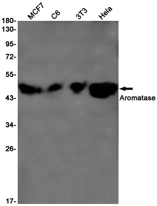 Aromatase Rabbit mAb ABZ2839