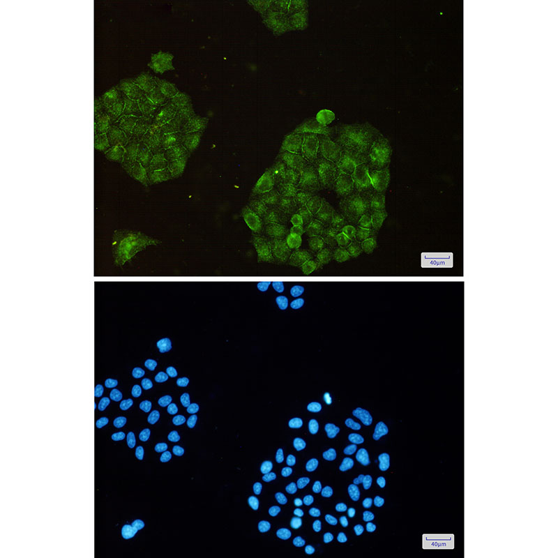 ARPC2 Rabbit mAb ABZ2840