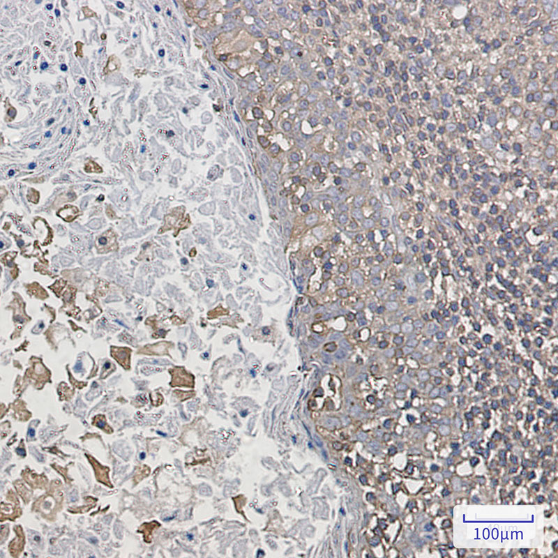 ARPC2 Rabbit mAb ABZ2840