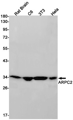 ARPC2 Rabbit mAb ABZ2840