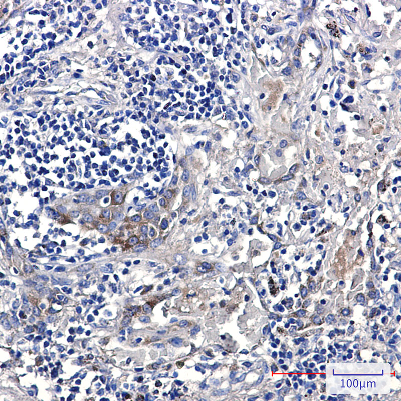 ERAP1 Rabbit mAb ABZ2841
