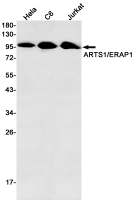 ERAP1 Rabbit mAb ABZ2841