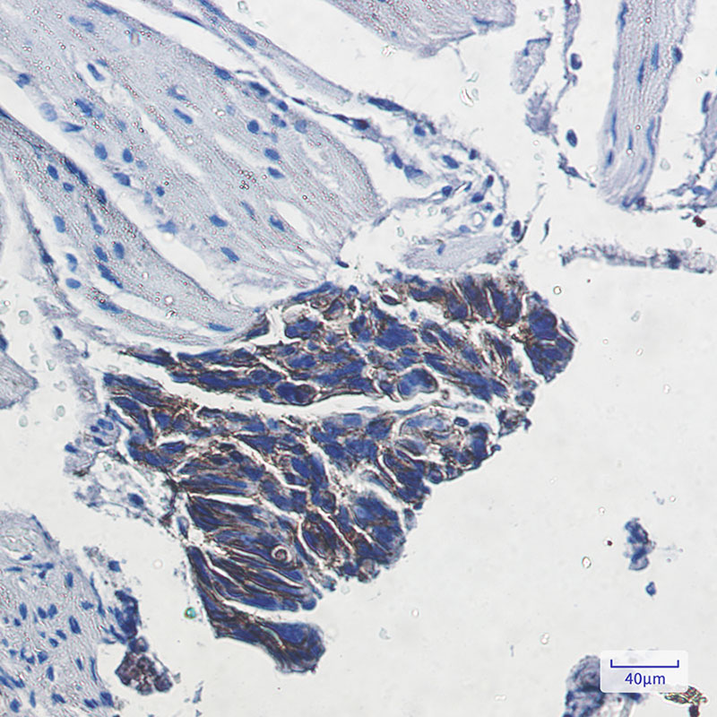 ATP1B1 Rabbit mAb ABZ2843