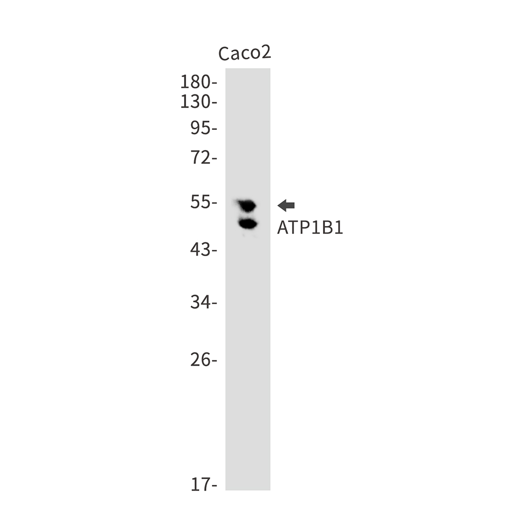 ATP1B1 Rabbit mAb ABZ2843