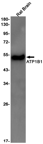 ATP1B1 Rabbit mAb ABZ2843