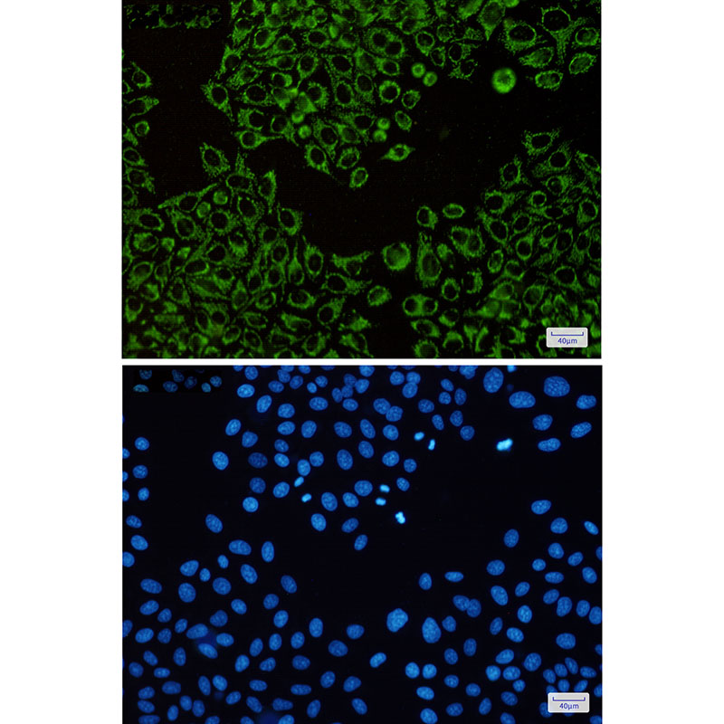 ATPB Rabbit mAb ABZ2846