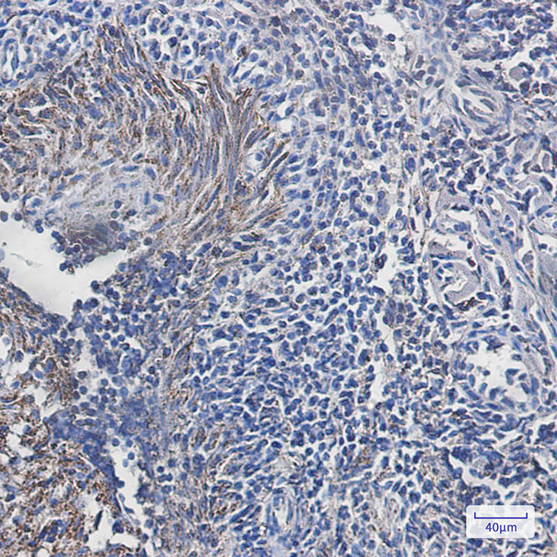 ATPB Rabbit mAb ABZ2846