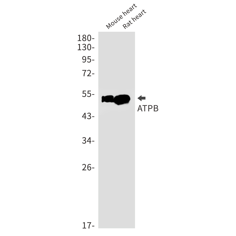ATPB Rabbit mAb ABZ2846