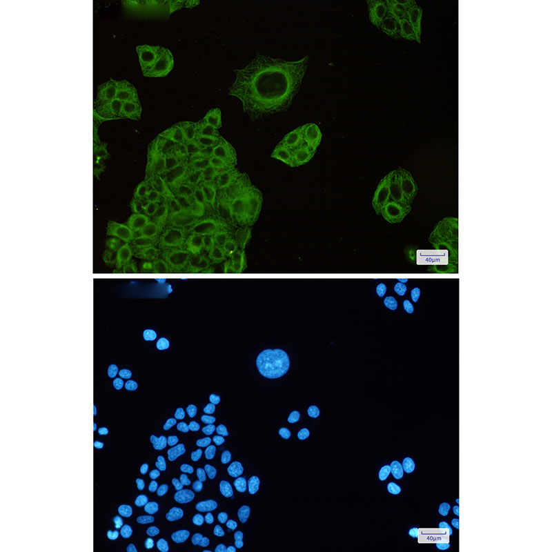 beta IV Tubulin Rabbit mAb ABZ2851