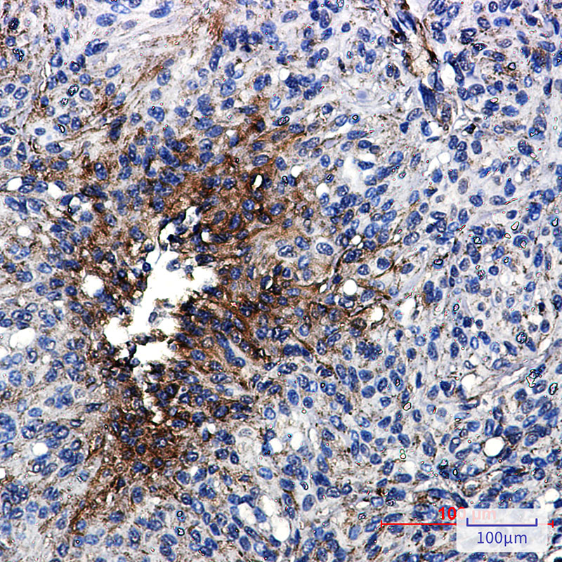 beta IV Tubulin Rabbit mAb ABZ2851