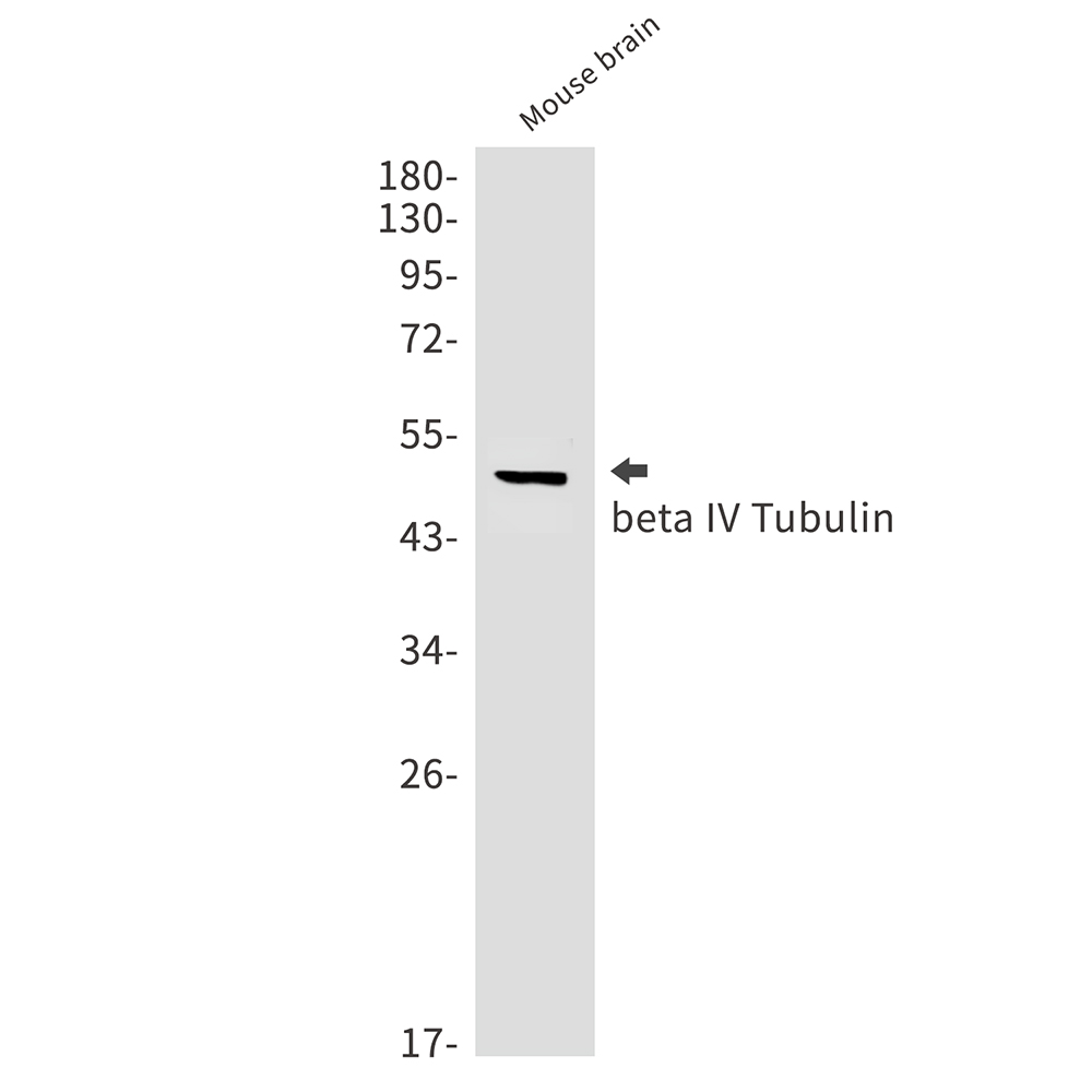 beta IV Tubulin Rabbit mAb ABZ2851