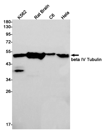 beta IV Tubulin Rabbit mAb ABZ2851