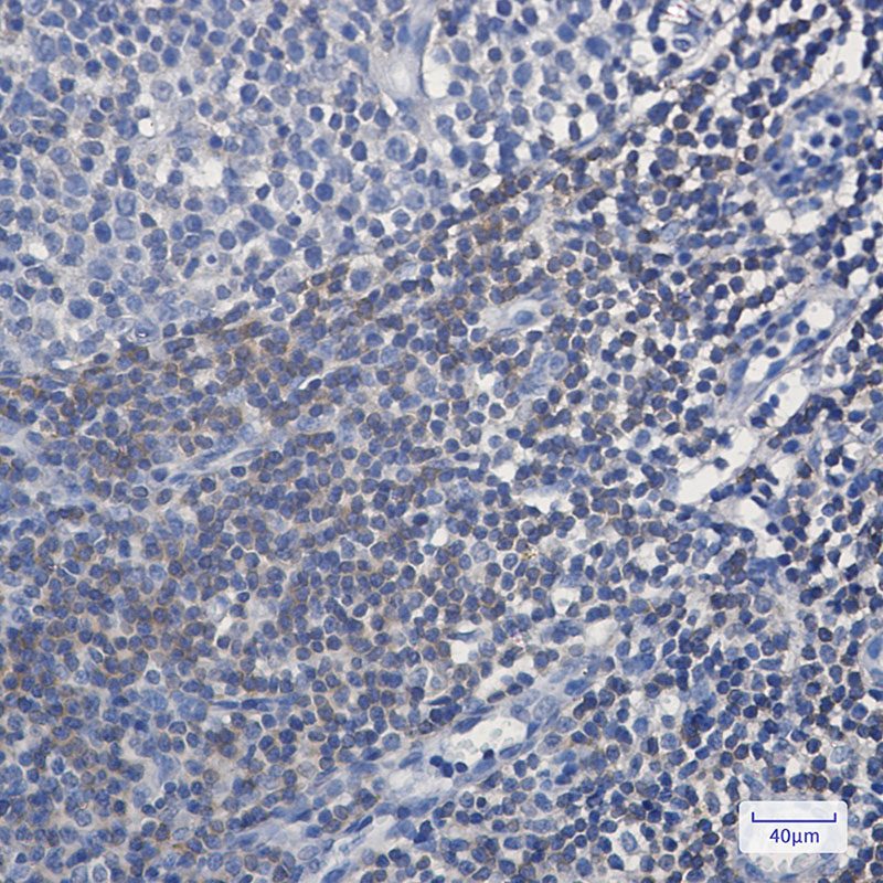 BIN1 Rabbit mAb ABZ2853