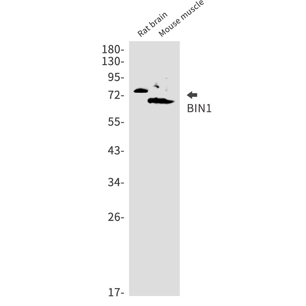 BIN1 Rabbit mAb ABZ2853