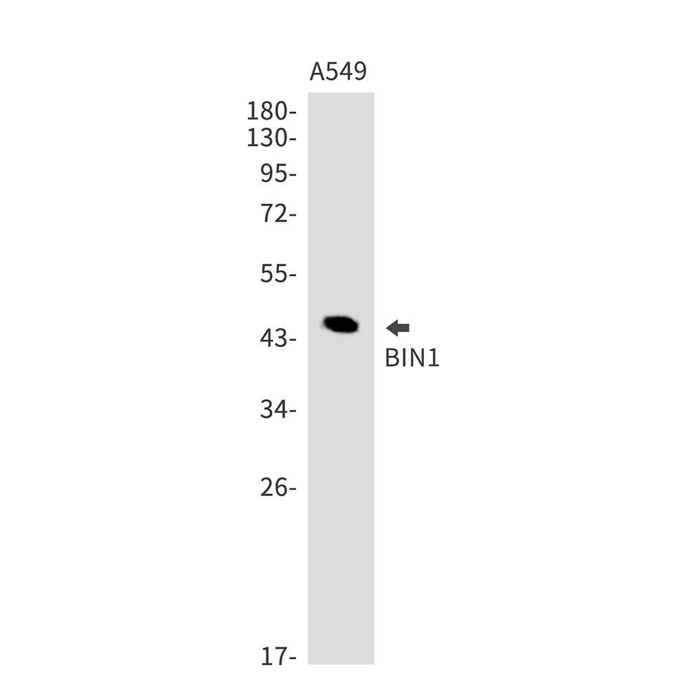 BIN1 Rabbit mAb ABZ2854