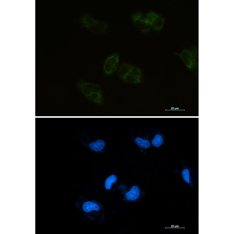 BMP4 Rabbit mAb ABZ2856