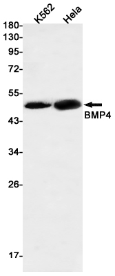 BMP4 Rabbit mAb ABZ2856