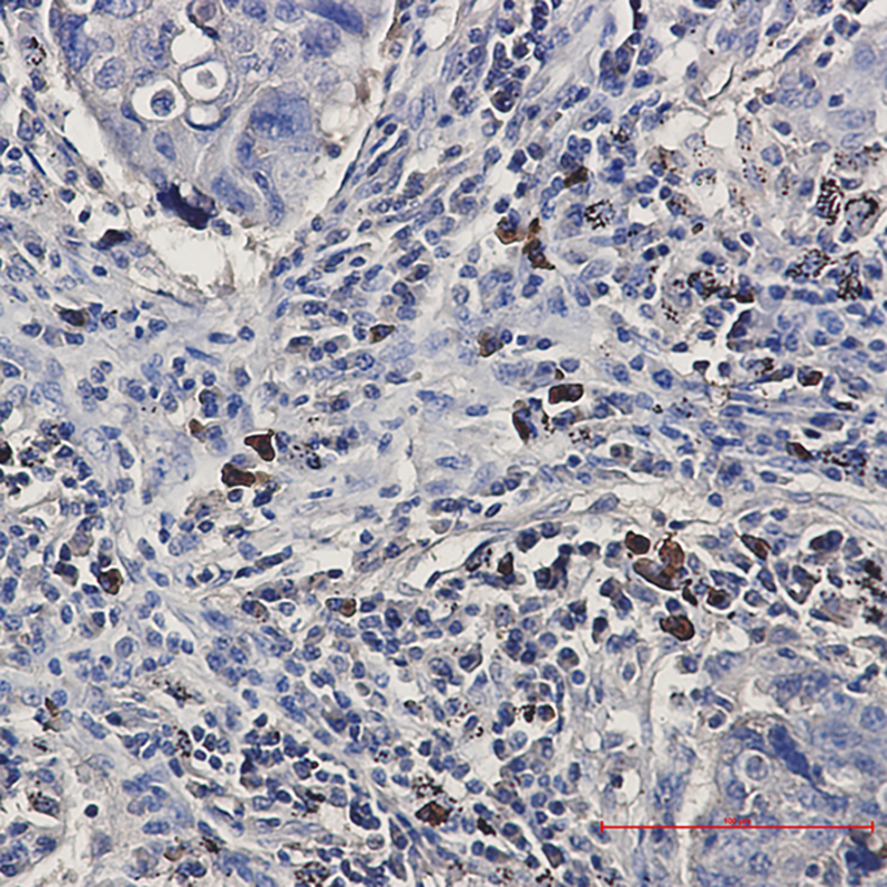 BNIP3L Rabbit mAb ABZ2857